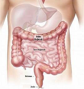 Bağırsak Tıkanması