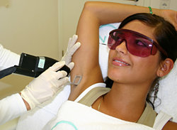 Lazer Epilasyonun Avantajları Nelerdir?