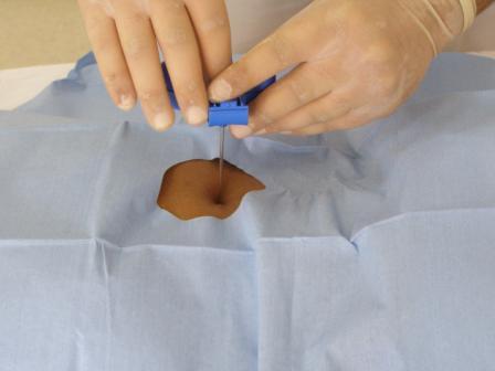 Kemik İliği Biyopsisi