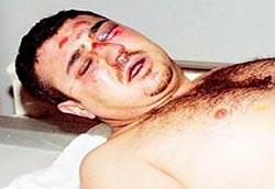 Onur Köksu Hayatini Kaybetti5