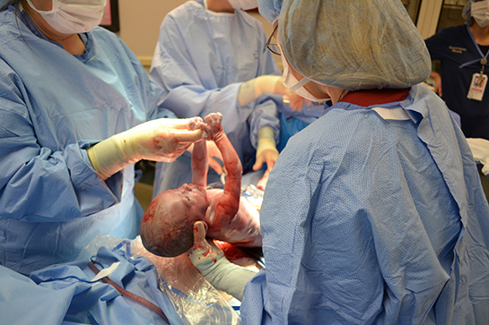 Sezaryenden sonra normal doğum yapılmaz