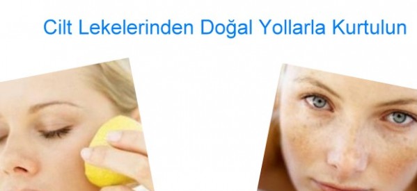 Cilt lekelerine doğal çözümler