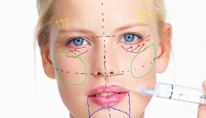Yağ Transfer Sistemi Nedir?