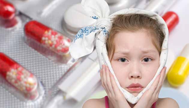 Çocuklarda Bulaşıcı Hastalıklar: Kabakulak