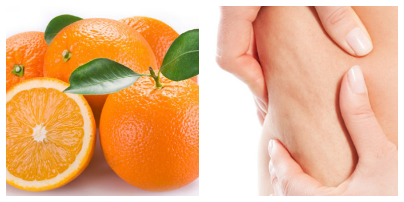 Selülite karşı doğal yöntemler