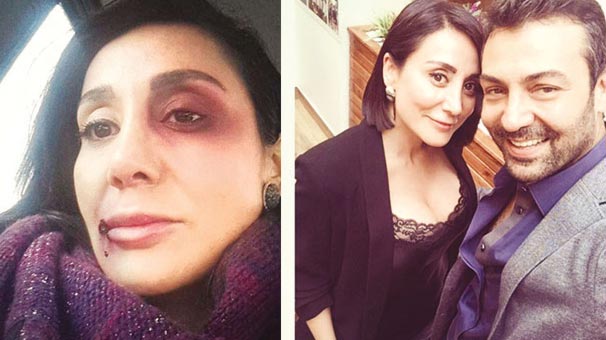 Saruhan Hünel Karagül’den Kovulacak mı?