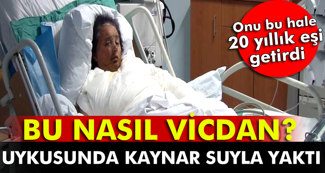 20 yıllık eşini yakan kocanın, serbest bırakılması kabul edilemez.