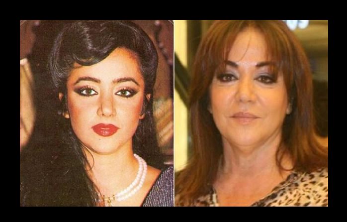 Ünlülerin Gençlik Fotoğrafları Ve Son Halleri