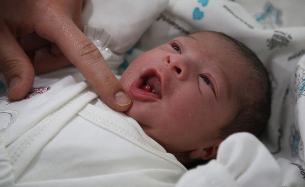 Bu Bebek “DİŞLİ DOĞDU”