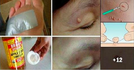 Et Benleri için Çörek Otu Yağı Tedavisi.. Bunu Kullananlar Bakın Nasıl Kurtuldu ?