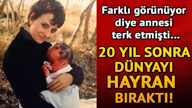 Farklı görüntüsü nedeniyle ailesi terk etmişti! 20 yıl sonra ise…