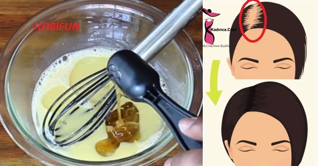 Saç Dökülmelerinizden ve Seyrek Cansız Saçlarınızdan Kurtulmanızı Sağlayacak 2 Saç Toniği Tarifi,Az ve Bulunabilir Malzemeli