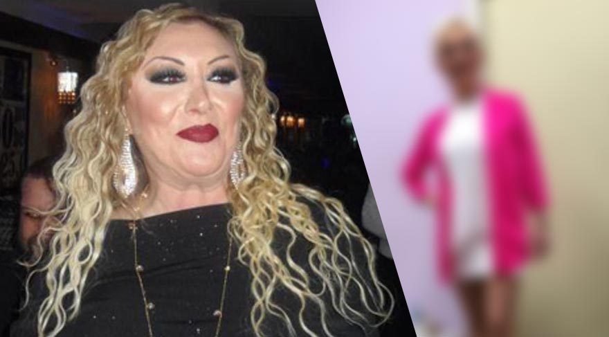 9 Ayda 70 Kilo Veren Güllü’yü Görenler Tanımakta Güçlük Çekiyor: Resmen Çökmüş