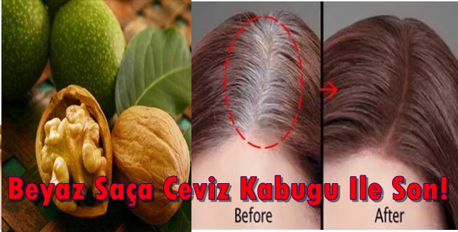 Beyaz Saça Ceviz Kabuğu İle Son!