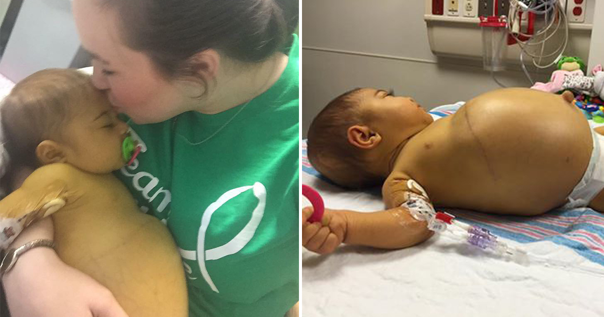 Bebeğin Karnı Giderek Şişiyordu – Doktorlar Anneye Acı Haberi Verdi