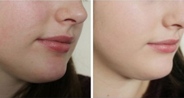 Berrak Bir Cilt İçin Her Evde Bulunan Malzemelerle Güzellik Garanti