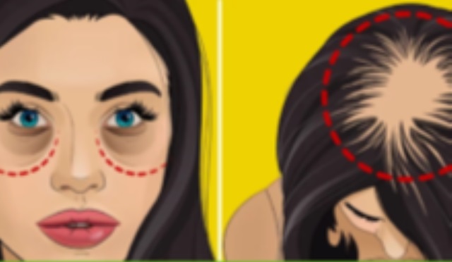 Hormon Dengesizliğinin 8 Belirtisinden Kaçı Sizde Var ?