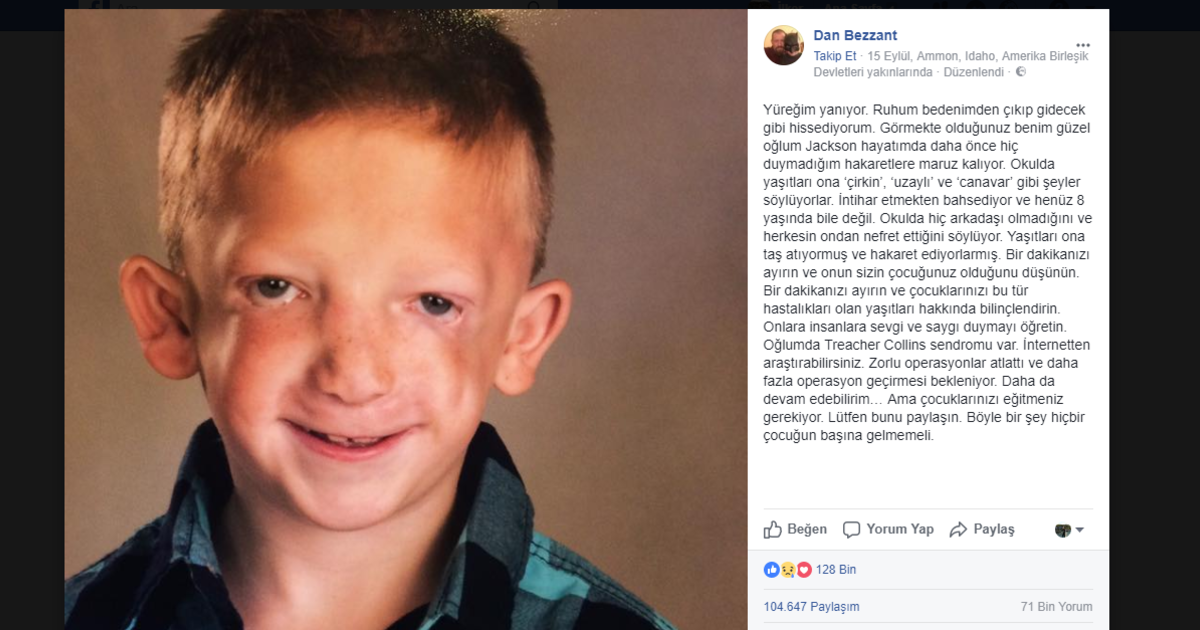 Kendisine Canavar Denilen 7 Yaşındaki Çocuk İntihar Etmek İstedi – Babası Oğluyla Dalga Geçenlere Böyle Bir Ders Verdi