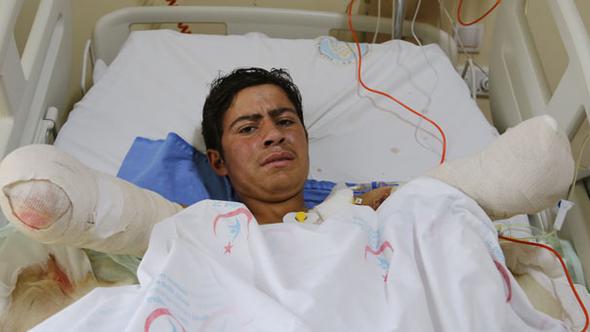 Kuşu kurtarırken ellerini kaybeden Ramazan’a iyi haber