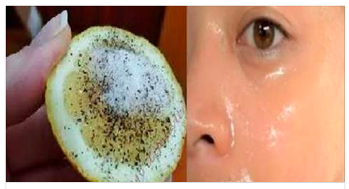 Siyah Noktalardan ve Ölü Deriden Kurtulmak Artık Çok Kolay Mucizevi Limon Yöntemini Denediniz mi ?