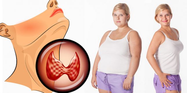 Tiroidi Daha Az Çalışan Kişiler Kilo Vermek İçin Ne Yapmalı?