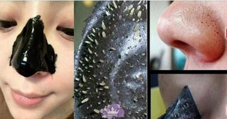 YUMURTA VE LİMON İLE SİYAH NOKTALARDAN KURTULUN