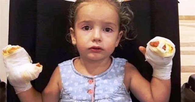 Uçan balon küçük kızı yaktı! – Çocuklarınıza Balon Alırken Bir Daha Düşünün