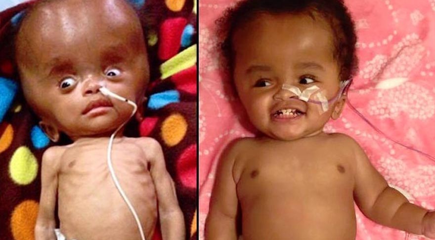 Çöpte bulduğu bebeği sahiplendi – son halini paylaştı