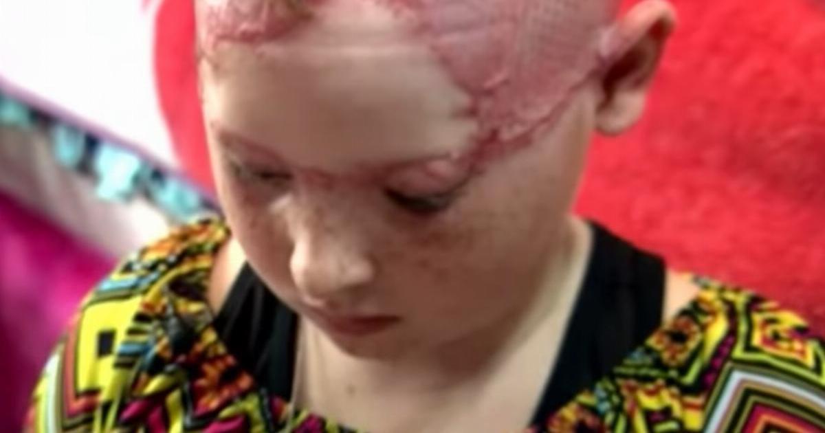 11 Yaşındaki Kız Ve Annesi Lunaparka Gitti – Annesinin Gözleri Önünde Kızın Kafa Derisi Yüzüldü