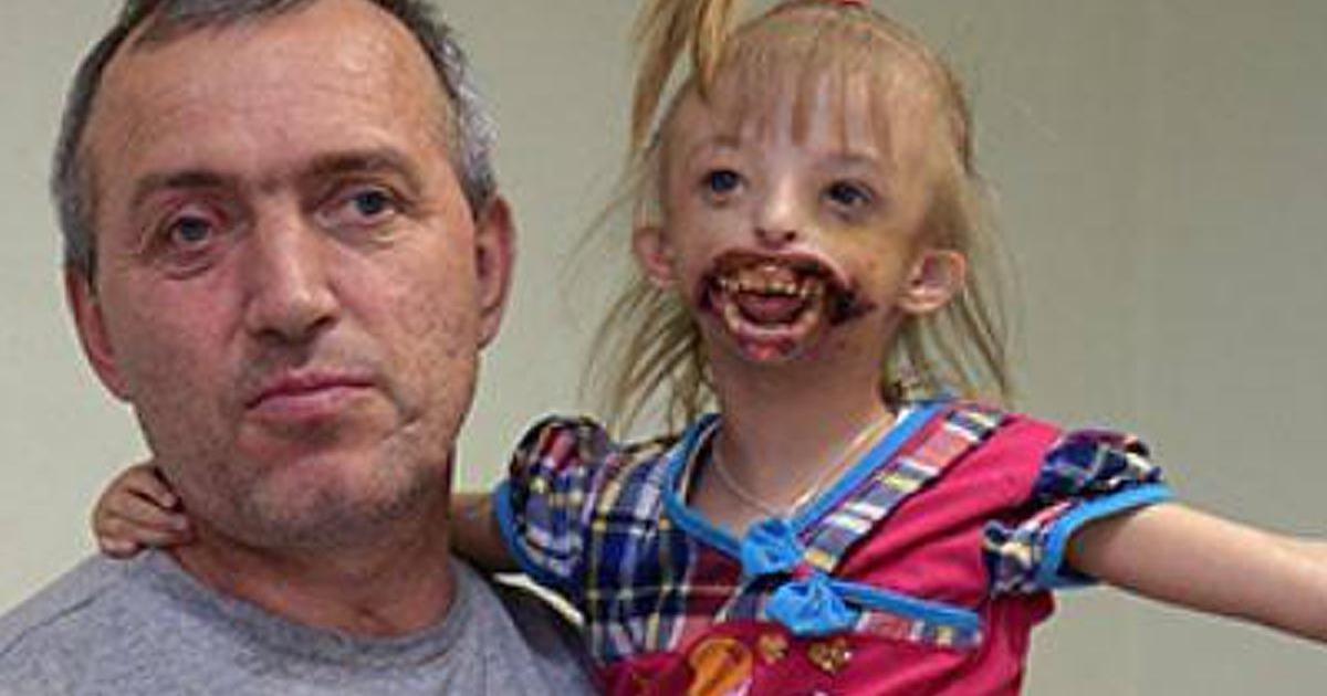 18 Yıl Sonra Baba Olacağını Duyunca Havaya Uçtu – Bebek Dünyaya Geldiğinde Doktorlar Şaşırdı