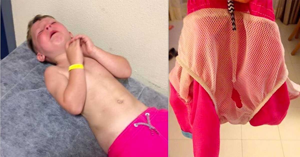 5 Yaşındaki Çocuk Denizden Oynarken Ağlamaya Başladı – Annesi Şortunu Çıkarınca Hastaneye Koştu