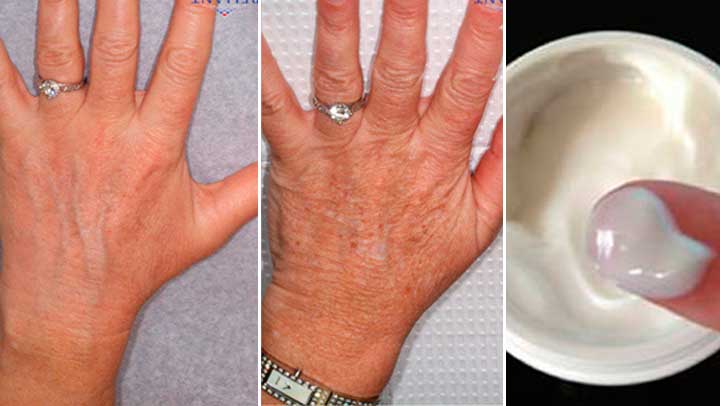 60 Yaşındayım Ancak Ellerim 30 Gibi Görünüyor, Sırrı Her Gün Bu Kremi Uygulamak