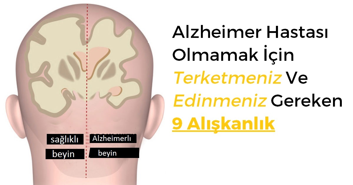 Alzheimer Hastası Olmamak İçin Terketmeniz Ve Edinmeniz Gereken 9 Alışkanlık