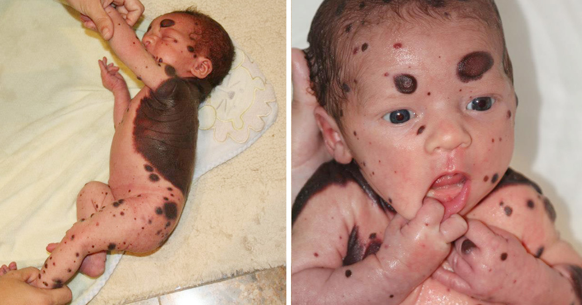 Anne Bebeğini Görünce Çok Şaşırdı – Doktorlar Gerçeğin Farkına Hemen Vardı