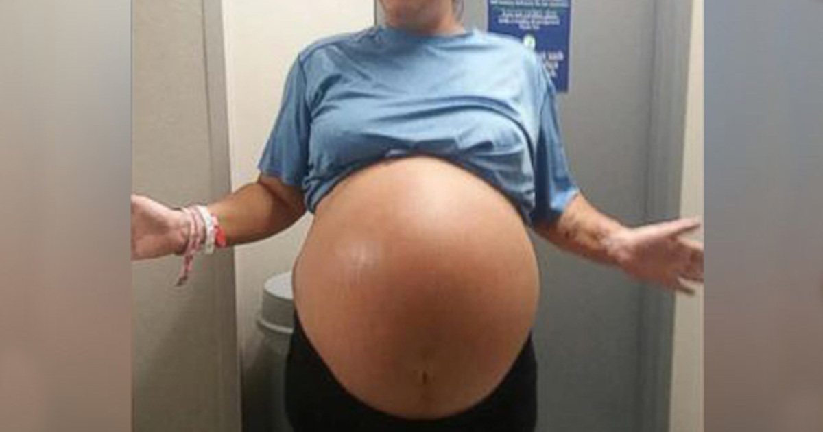 Annenin Karnı Anormal Şekilde Büyüyordu – Doğum Sonrasında Gerçek Ortaya Çıktı