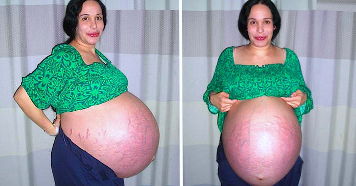 Aynı Anda 8 Bebek Dünyaya Getiren Anne Yıllar Sonra Gerçeği Açıkladı