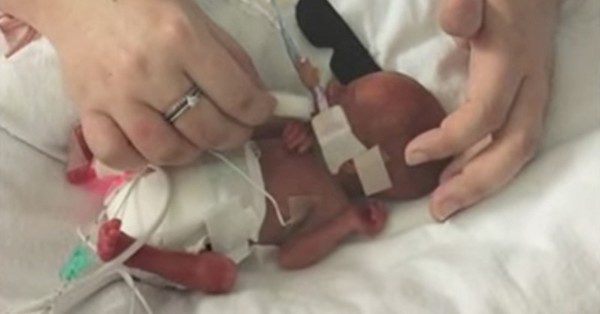 Bebeği Yalnız Gömülmesin Diye Oyuncak Tavşan Aldı – Haftalar Sonra Doktorlar Gözlerine İnanamadı