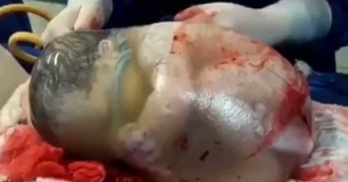 Bebek Bu Halde Dünyaya Geldi – Doktorlar Gözlerine İnanamadılar