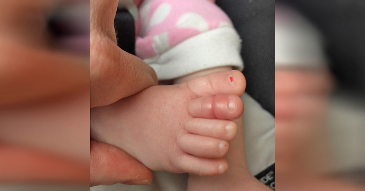 Bebeklerinin ateşi çıktı. Sonra annesi tırnağında çok İlginç bir şey keşfetti. Çift diğer anne babaları bu bilinmeyen tehlike hakkında uyarıyor.