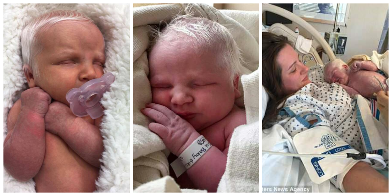 Bütün Dünyanın Fotoğraflarını Paylaştığı Pamuk Prensese Benzeyen O Bebek