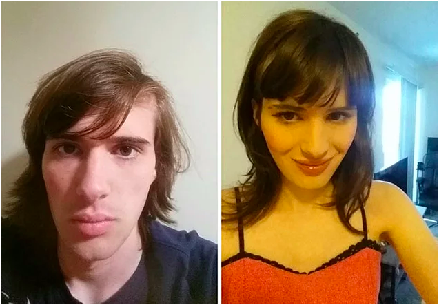 Cinsiyet Değiştirmek İçin Gördüğü 17 Aylık Hormon Tedavisi Boyunca, Değişimini Fotoğraflayan Transeksüel Kadın