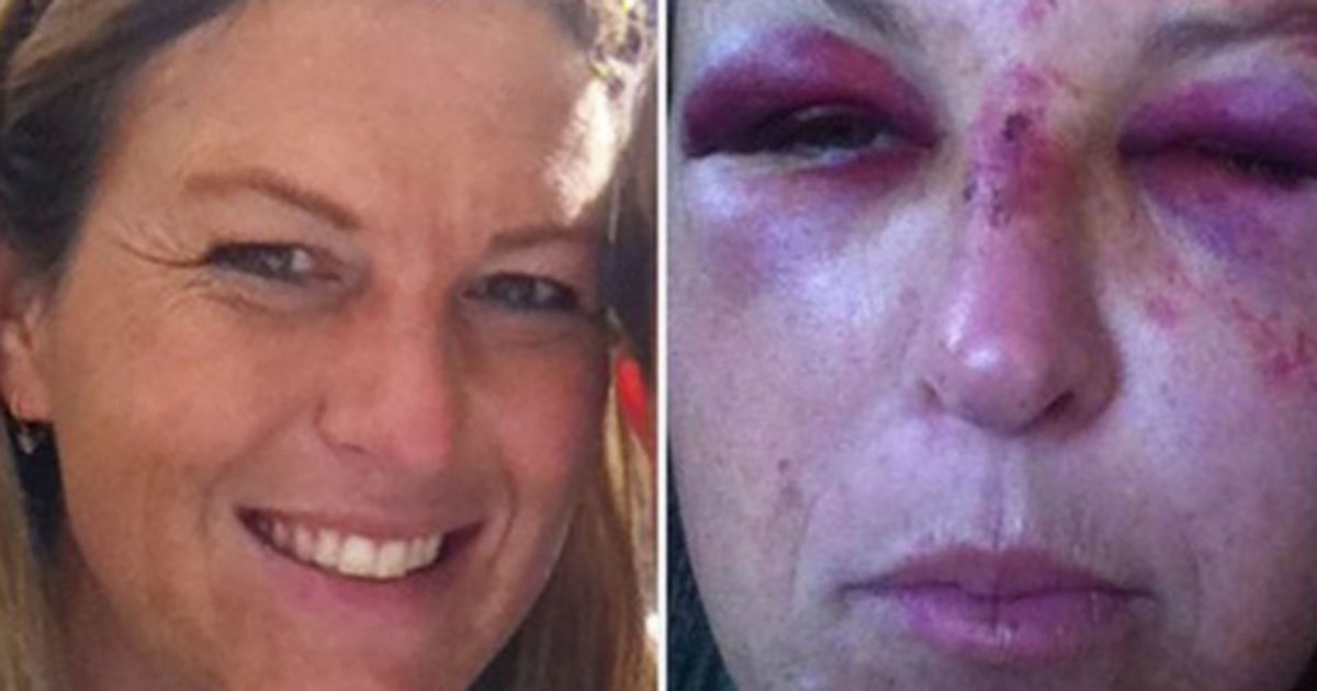 Çocukların Bakıcısı Baba Tarafından Darp Edildi – Şimdi Milyonlar O Kadını Konuşuyor