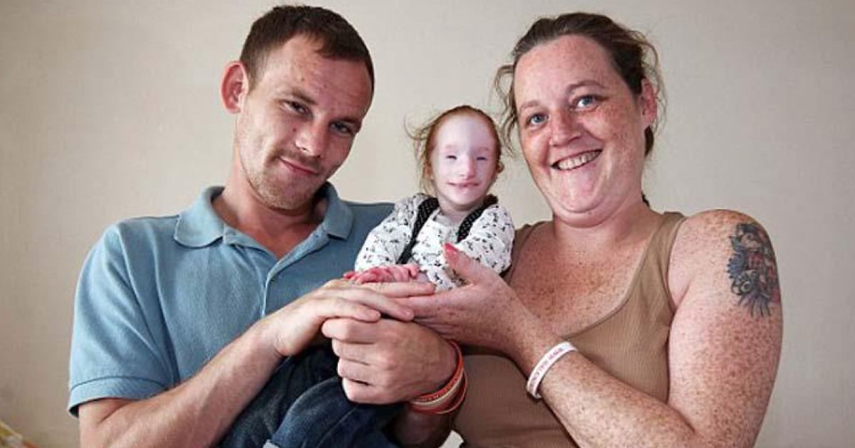 Doktorların Fazla Yaşayamacağını Söylediği Küçük Kız Herkesin Yüzünü Bakın Nasıl Kızarttı