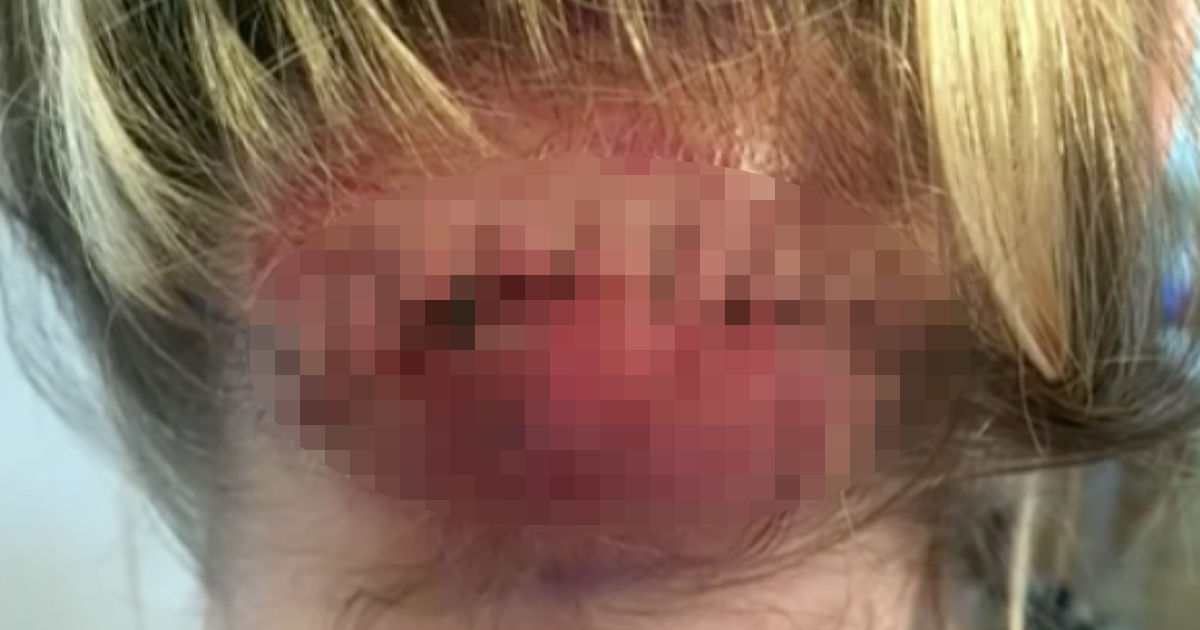 Dört Doktor Da Bir Şeyi Olmadığını Söyledi – Beşince Doktor Acı Haberi Böyle Verdi