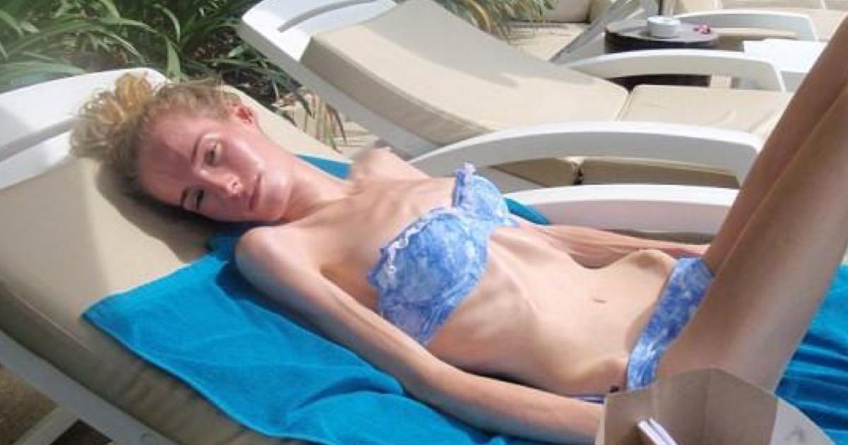 Her Sabah Erkenden Hasta Kızının Odasına Giden Babanın Yaptığını Öğrenince Gözyaşlarına Boğulacaksınız