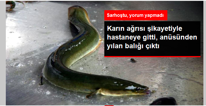 Karın Ağrısı Şikayeti ile Hastaneye Giden Adamın Anüsünden Yılan Balığı Çıktı