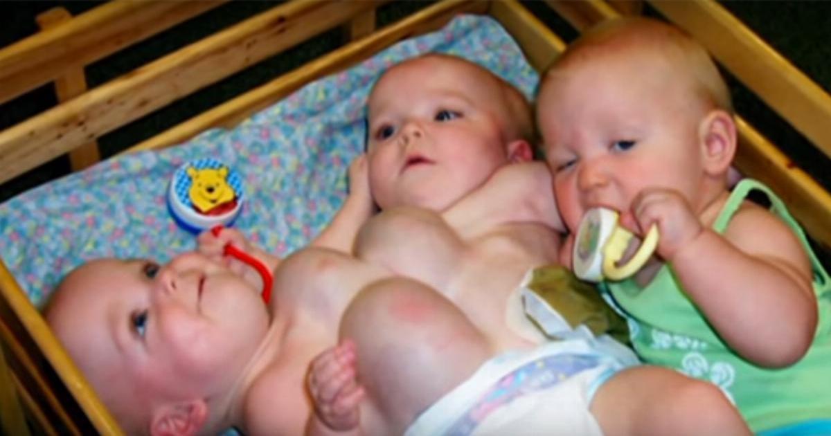 Tarihi Üçüzler Herkesi Şaşırttı – Doktorlar Gözlerine İnanamadılar