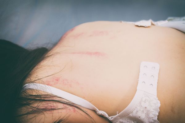 Tecavüz Vakalarının Önüne Geçmek İsteyen Üç Genç Kız Bakın Nasıl Bir Buluş Yaptılar