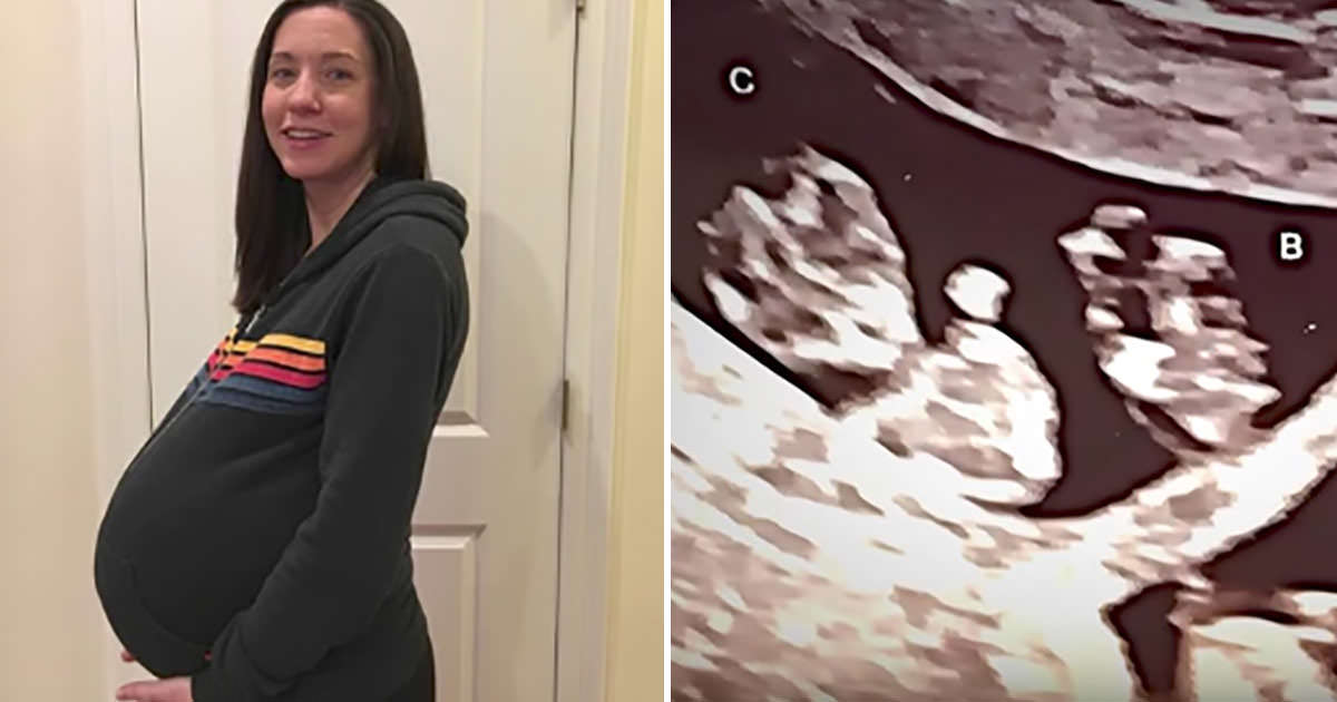 Yıllardır Çocukları Olmadı – Olunca Bakın Kaç Tane Oldu