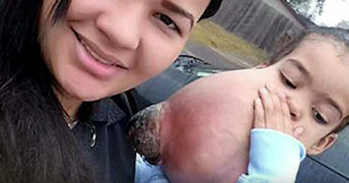 Çenesinden 2 Kiloluk Tümör Çıkarılan 3 Yaşındaki Kız Bakın Bugün Nasıl Görünüyor